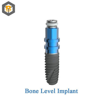 Προσαρμοσμένο 2D / 3D οδοντικό εμφύτευμα Abutment βίδα εξαγωνική εξωτερική για επαγγελματικό οδοντικό εργαστήριο
